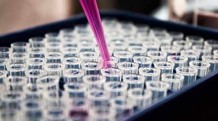 Immagine decorativa: Candida auris sta diventando un nome familiare: impresa non facile per un fungo! Purtroppo la celebrità è legata ai danni e alla sua resistenza ai farmaci